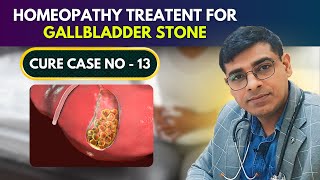 Gallbladder Stone Case No 13  Homeopathy Treatment for Gallbladder Stone Dr Abhik Ghosh Homeopathy [upl. by Ssur493]