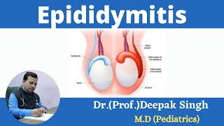 Epididymitis  Inflammation in epididymis  Deepak PD Singh [upl. by Monty]