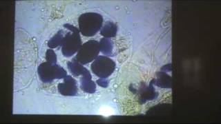 Observaciones al microscopio de células eucariotas 2mp4 [upl. by Anailuig]