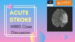 MBBS Case Presentation  Acute Stroke [upl. by Aiyekal390]