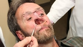 The Man With A Hole In His Face Body Bizarre Episode 3 [upl. by Ocirred]