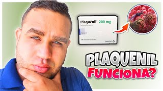 PLAQUENIL Hidroxicloroquina 200 mg PARA QUE SIRVE  EFECTOS SECUNDARIOS  EMBARAZO  LUPUS [upl. by Kuehnel]