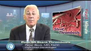 Heart Minute  PostMI Stent Thrombosis [upl. by Ricki67]