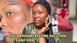 HOW TO PROPERLY USE THE ORDINARY PEELING SOLUTION FOR BEGINNERS  Step by Step Guide [upl. by Harod984]