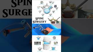 Spine Surgery with Duo™ Ti Expandable Interbody Fusion System from Spineology 3danimation short [upl. by Dnaltiak613]