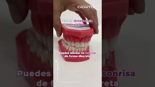 🎃 ¡25 en ortodoncia invisibleAprovecha hasta el 31 de octubre OrtodonciaInvisible Dentix [upl. by Wilmette]