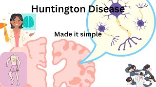 Huntington disease  symptoms MRI findings and treatment [upl. by Wilbert208]