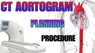 CT AORTOGRAM  planning and procedure explained [upl. by Melliw]