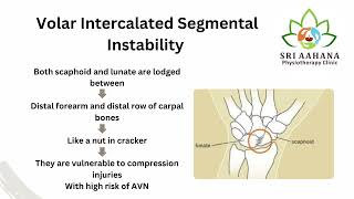 VISI  Volar Intercalated Segmental Instability [upl. by Carboni942]