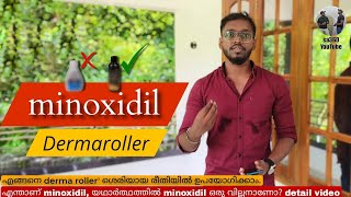 Hair Transplantation Malayalam  minoxidil അത്ര കുഴപ്പക്കാരനല്ല  minoxidil detail video [upl. by Pulling937]