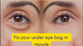 HOW TO GET RID OF PUFFY EYES  DARK UNDER EYES IN MINUTES [upl. by Mahmoud675]