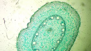 Monocot Stem Under the Microscope [upl. by Yengac]