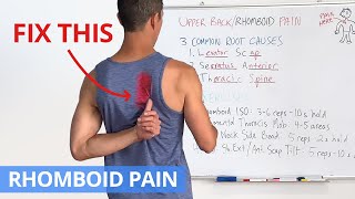 How to Fix Upper Back  Rhomboid Pain for GOOD 4 Effective Exercises [upl. by Hauser]