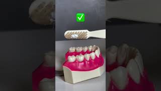 Correct way of Brushing technique dentalcare dentalhygiene dentalhygienelife dentalclinic clean [upl. by Meredi]