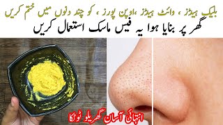 Remove Black Heads  White Heads and Open Pores in Just 1 Minute with Very Simple Homemade Mask [upl. by Southard630]