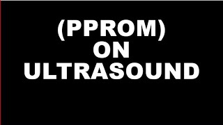 Preterm Premature Rupture Of Membrane On Ultrasound [upl. by Nohpets]