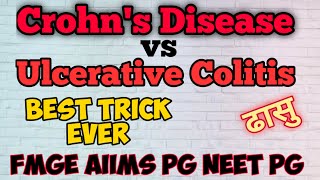 Crohns Disease vs Ulcerative Colitis Tricks  Mnemonic  Neet Pg  Fmge Special [upl. by Chaves622]