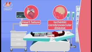 EECPa noninvasive and US FDA approved treatment for ischemic heart diseases [upl. by Noremmac]