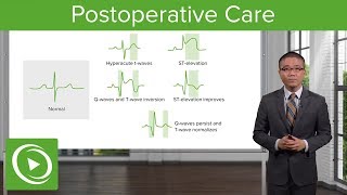 Postoperative Care – Surgery  Lecturio [upl. by Redep]