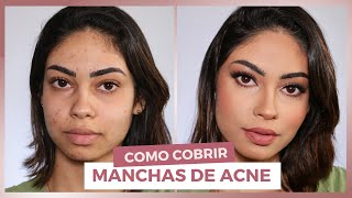 MAQUIAGEM para cobrir manchas de ACNE l Tutorial passo a passo [upl. by Ahcsim47]