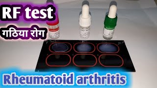 RF agglutination test  Rheumatoid arthritis test  गठिया रोग का जाँच और लक्षण । [upl. by Yadahs]