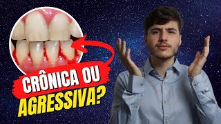 Saiba diferenciar  Periodontite Agressiva x Crônica Periodontia [upl. by Nymzaj648]