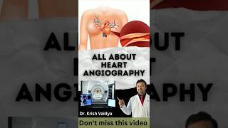 All about heart angiography heart heartattack hearthealth shorts shortfeed drkrishvaidya [upl. by Cralg]