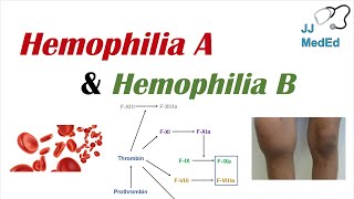 Hemophilia A vs Hemophilia B  Genetics Symptoms and Treatment [upl. by Holbrook352]