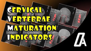 CVMI  Cervical Vertebrae Maturation Indicators  Growth and Development  Orthodontic Atheneum [upl. by Kristoforo]