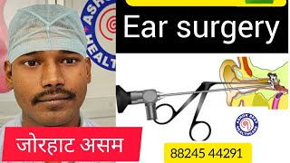 दूरबीन द्वारा कान के मेडिकल बिंदुओं का सफल निवारण endoscopic ear surgery 👂 ashokbest jaipur [upl. by Kirrad]