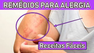 ALERGIA NA PELE  ECZEMA  O QUE É [upl. by Cirderf321]