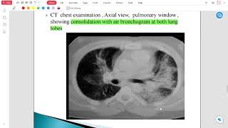 Radiology Lec 4 [upl. by Ydahs]