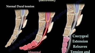 Coccyx Tailbone pain coccydynia  Everything You Need To Know  Dr Nabil Ebraheim [upl. by Claudianus]