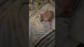 Miracle Baby Born With His Brain OUTSIDE Of His Head 😲 [upl. by Tegdig]