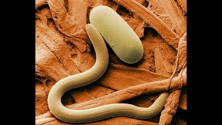 What are nematodes [upl. by Nner]