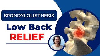 Spondylolisthesis Back Pain Relief Exercises and Adjustments [upl. by Gusba]