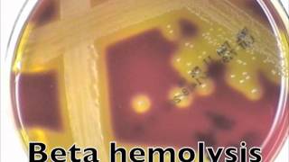 Comparison of hemolysis on blood agarmov [upl. by Ajna]