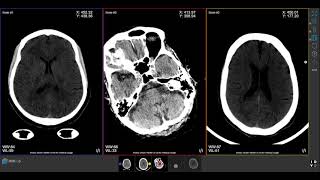 IMAIOS Anatomy medical imaging [upl. by Campman]