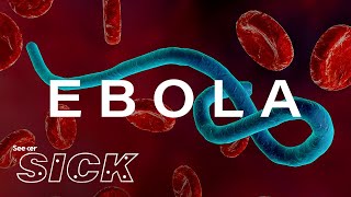 What Ebola Does to the Body [upl. by Pages]