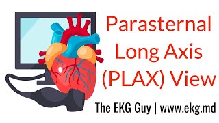 Parasternal Long Axis View  ECHO Course l The EKG Guy  wwwekgmd [upl. by Yr873]