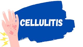 Cellulitis Skin Infection  Treatment erysipelas [upl. by Siloum22]