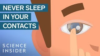 What Happens When You Sleep In Your Contact Lenses [upl. by Siro]