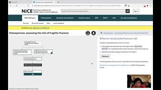 Learning from passmedicine questions  Assessing risk of fragility fracture FRAX [upl. by Lamok]