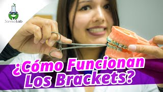 ¿Cómo funcionan los brackets  Dentista de Confianza  SONRISALAB [upl. by Karissa176]