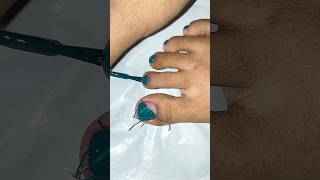 🩷💙💅Striping Tape Designsnailart toenails toenailart nails yt art viralvideos nailart short [upl. by Araic]