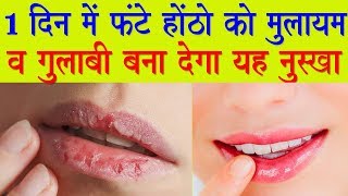 In Just 1 Day Cracked Lips to Get Soft Pink Lips Cracked Lips Homemade Solutions in Hindi [upl. by Colson587]