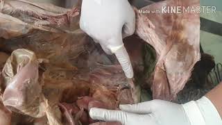 Dissection of Peritoneal Cavity by DrMeetu Agarwal [upl. by Adanama954]