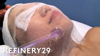 High Frequency Facial For Clear Skin  Beauty With Mi  Refinery29 [upl. by Acalia]