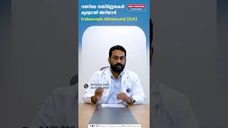 വയറിലെ സങ്കീർണ്ണതകൾ കൃത്യമായി അറിയാൻ Endoscopic Ultrasound EUS  Dr Anup S Nair [upl. by Encratia891]