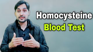 Homocysteine Blood Test  Homocysteine Metabolism [upl. by Dnaletak]